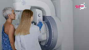 O preventivi brine 55 odsto